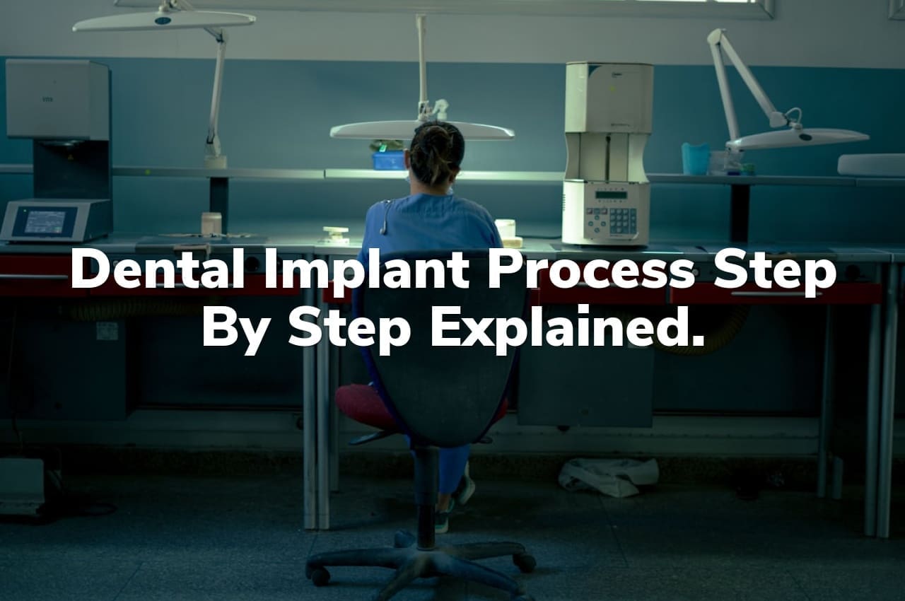 Dental implant process step by step explained.